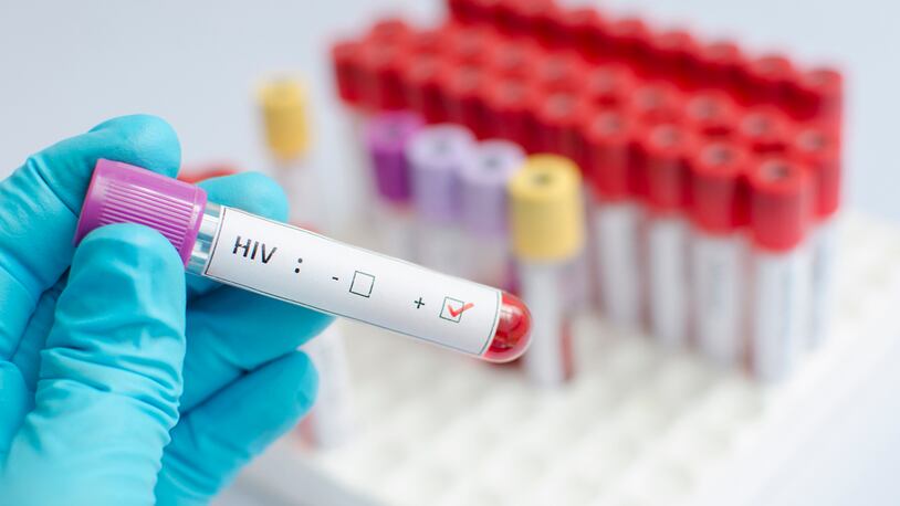 Blood sample positive with HIV