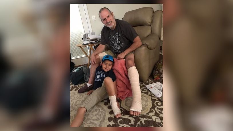 Barry Briggs, after treatment for flesh-eating bacteria and his son, Liam, who has an ankle injury. CONTRIBUTED
