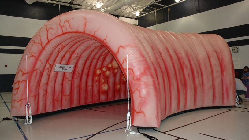 A giant inflatable walk-through colon is used to educate the community on their risk of acquiring colorectal cancer, how to get screened, and how to prevent cancer from reaching them or their family members. CONTRIBUTED