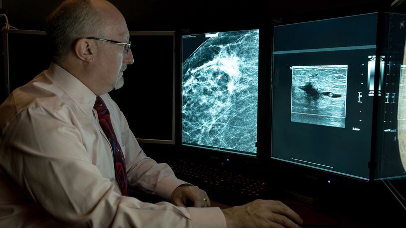 Diagnostic radiologist Dr. William Meyers with Kettering Health reads an ultrasound to determine the seed location and identify the area of affected breast tissue to be removed. CONTRIBUTED