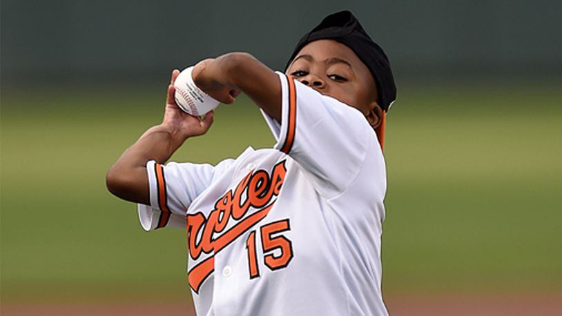 Nine-year-old Zion Harvey, the world's first child to receive a bilateral hand transplant, throws out the first pitch before the Baltimore Orioles and Texas Rangers baseball in Baltimore, Tuesday, Aug. 2, 2016. Harvey, who lost his hands and feet to a serious infection has become the youngest patient to receive a double-hand transplant, surgeons said Tuesday.