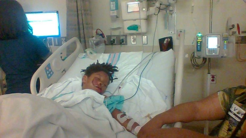 A 6-year-old boy is recovering at Dayton Children’s Hospital after being attacked by a dog in Springfield.