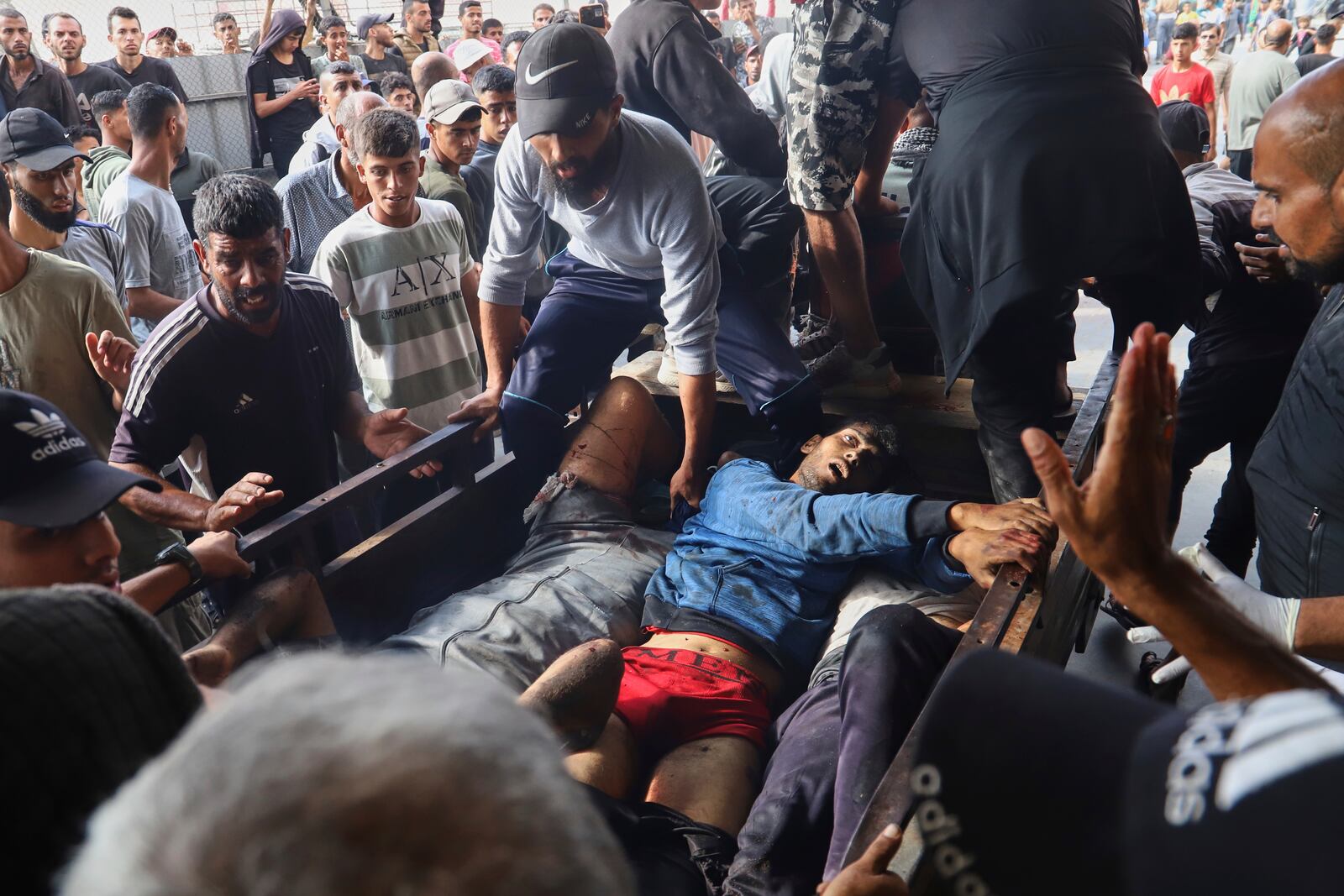 Palestinians injured in an Israeli strike are brought to Nasser Hospital in Khan Younis, southern Gaza Strip, Tuesday, June 17, 2025. (AP Photo/Mariam Dagga)