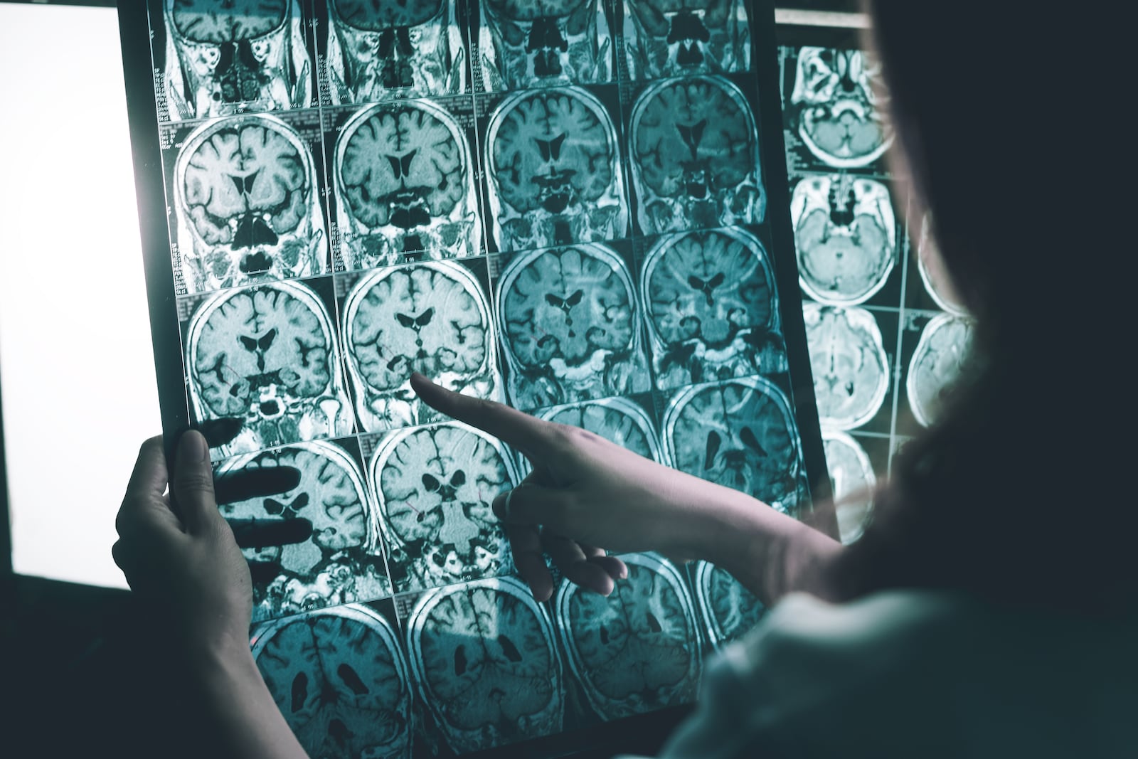 Most people ― nearly four in five Americans, or 79% ― would want to know if they have Alzheimer’s before symptoms start to interfere with day-to-day life, a new survey from the Alzheimer’s Association shows. (Photo: Business Wire)