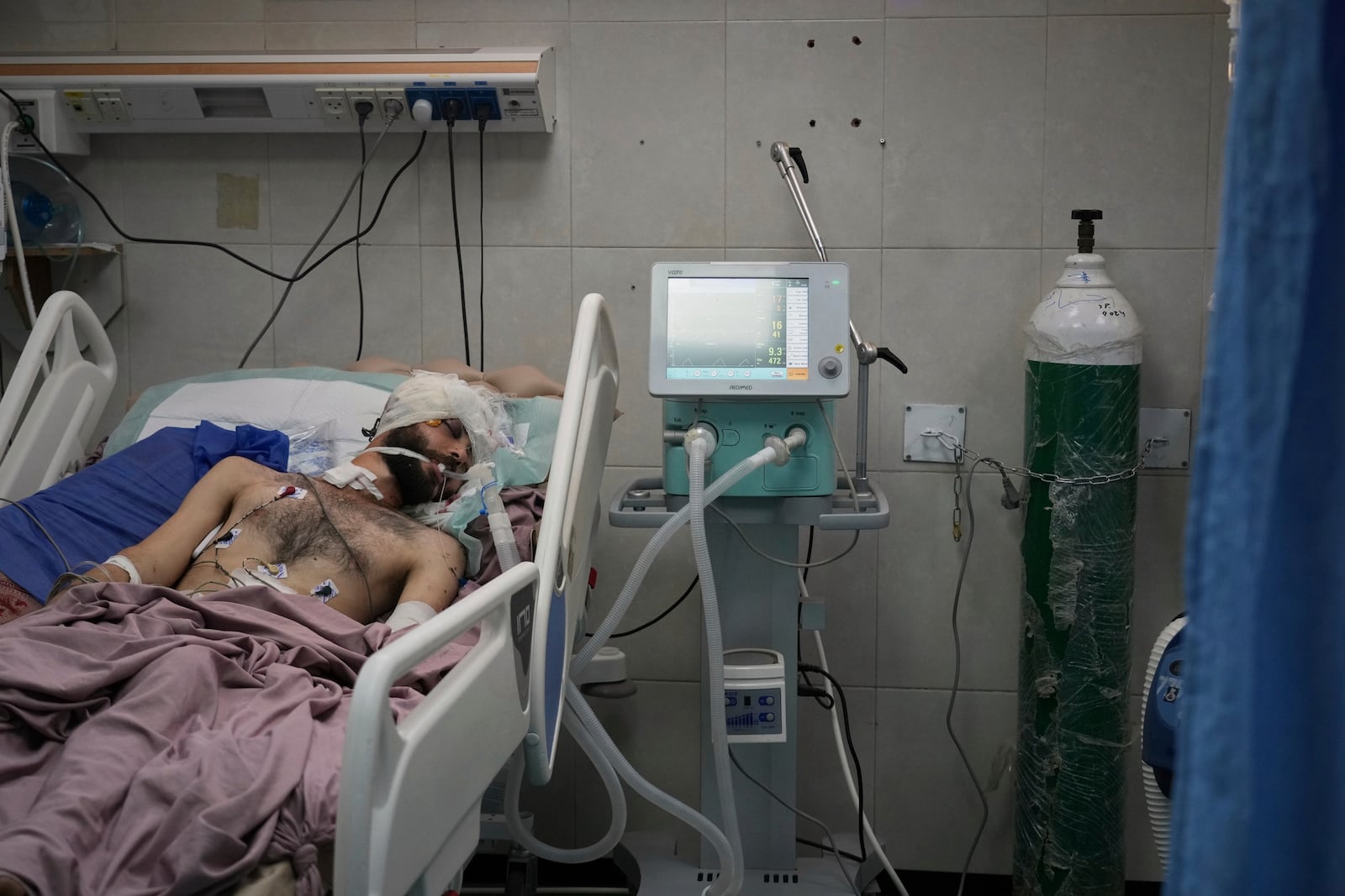 Mahmoud Al-Beyram, who was injured in the head when his family home was targeted in an Israeli army strike, lies in bed in the intensive care unit at Nasser Hospital in Khan Younis, Gaza Strip, Tuesday, May 6, 2025. (AP Photo/Abdel Kareem Hana)