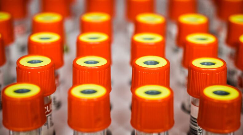 The Clark County Combined Health District has reported 38 cases of Hepatitis A have been investigated as of Feb. 5, 23 of which are connected to the current outbreak reported in Ohio, the health district said in a media release Monday. NICK GRAHAM/STAFF