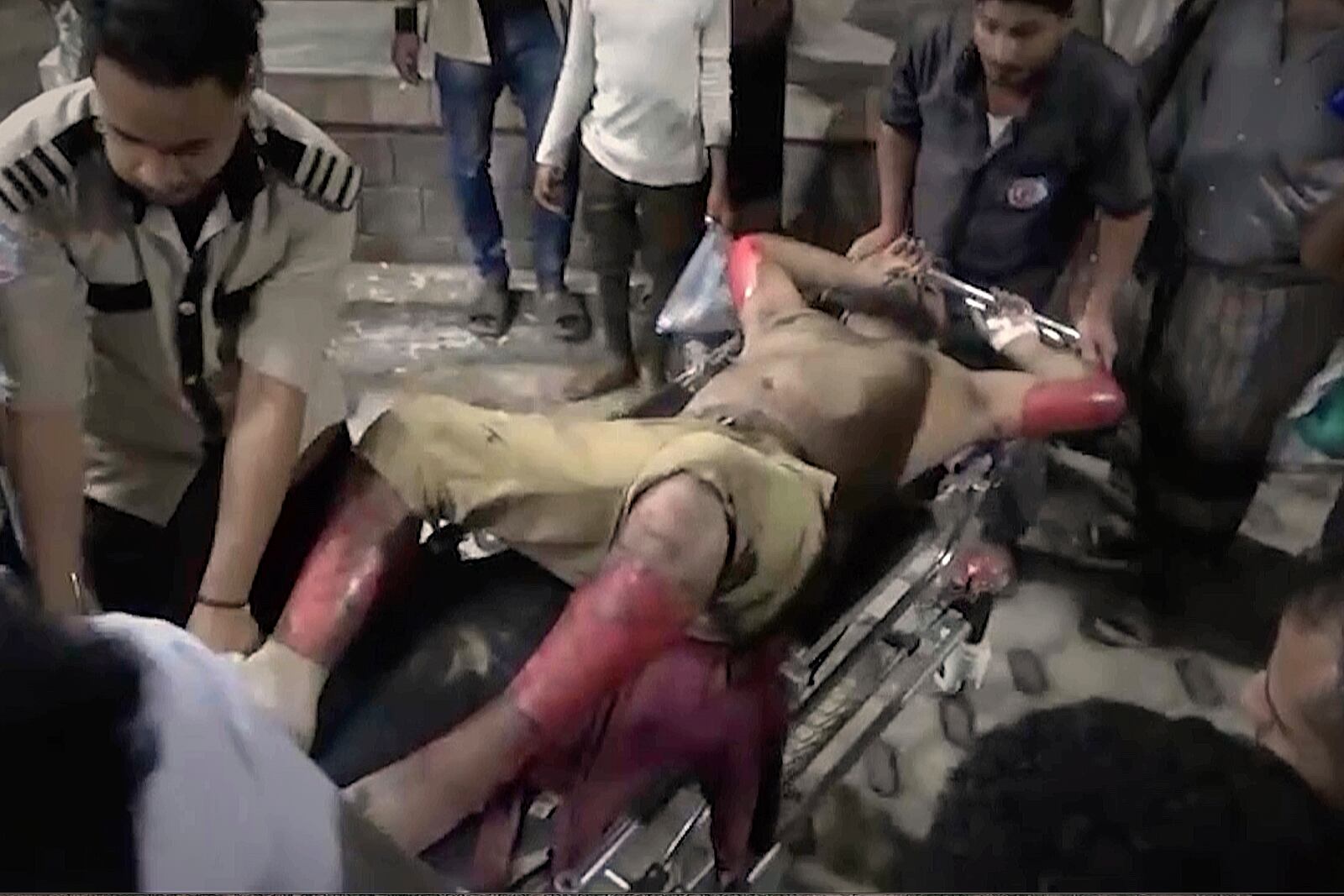 This photo taken from video released by Al Masirah TV channel shows medics carrying a wounded man into the hospital after U.S. airstrikes targeted the Ras Isa oil port held by Yemen's Houthi rebels in Hodeida, Yemen, Friday, April 18, 2025.( Al Masirah TV via AP)