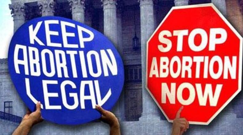 Ohio may ban abortions once Down syndrome diagnosis made