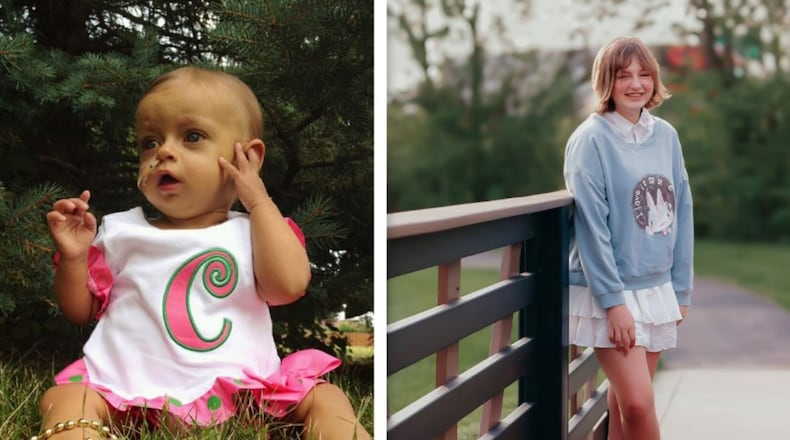 Pictured on the left is Claire Kaufman as an infant in 2012 as her family and she wait for a new liver after she was born with a rare liver disease. Kaufman was able to get a liver transplant in 2013, and pictured on right is Kaufman as a 14-year-old in her hometown of Enon. CONTRIBUTED