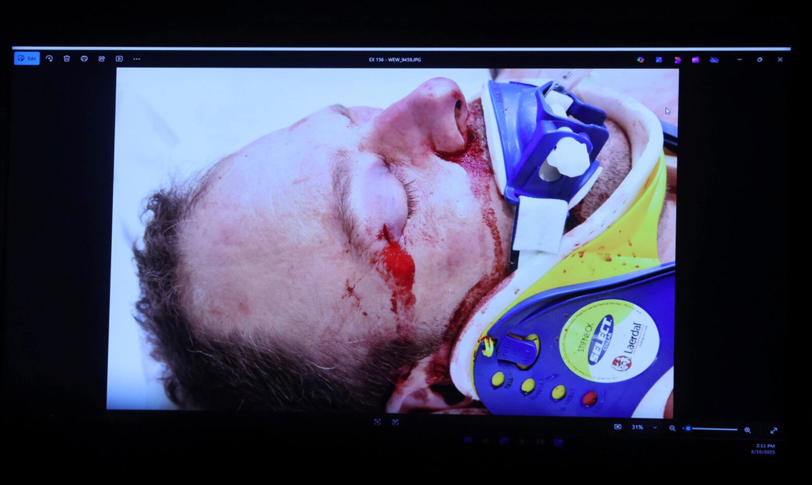 EDS NOTE: GRAPHIC CONTENT - An autopsy photo of deceased Boston Police Officer John O'Keefe is displayed during the Karen Read retrial, Tuesday, June 10, 2025, in Dedham, Mass. (Matt Stone /The Boston Herald via AP, Pool)