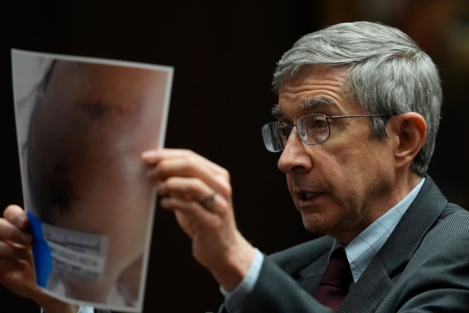 Forensic medical examiner Dr. Marco Ross presents photographic evidence before the jury during the trial of three former Memphis police officers accused in the 2023 fatal beating of Tyre Nichols, Wednesday, April 30, 2025, in Memphis, Tenn. (AP Photo/George Walker IV, Pool)
