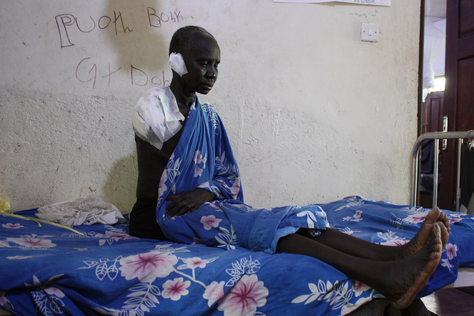 Wiyuach Makuach, 60 years old, who lost her arm in an airstrike on a hospital operated by Doctors Without Borders (MSF), sit in a hospital bed in Akobo, South Sudan, Sunday, May 25, 2025. (AP Photo/Joseph Falzetta)