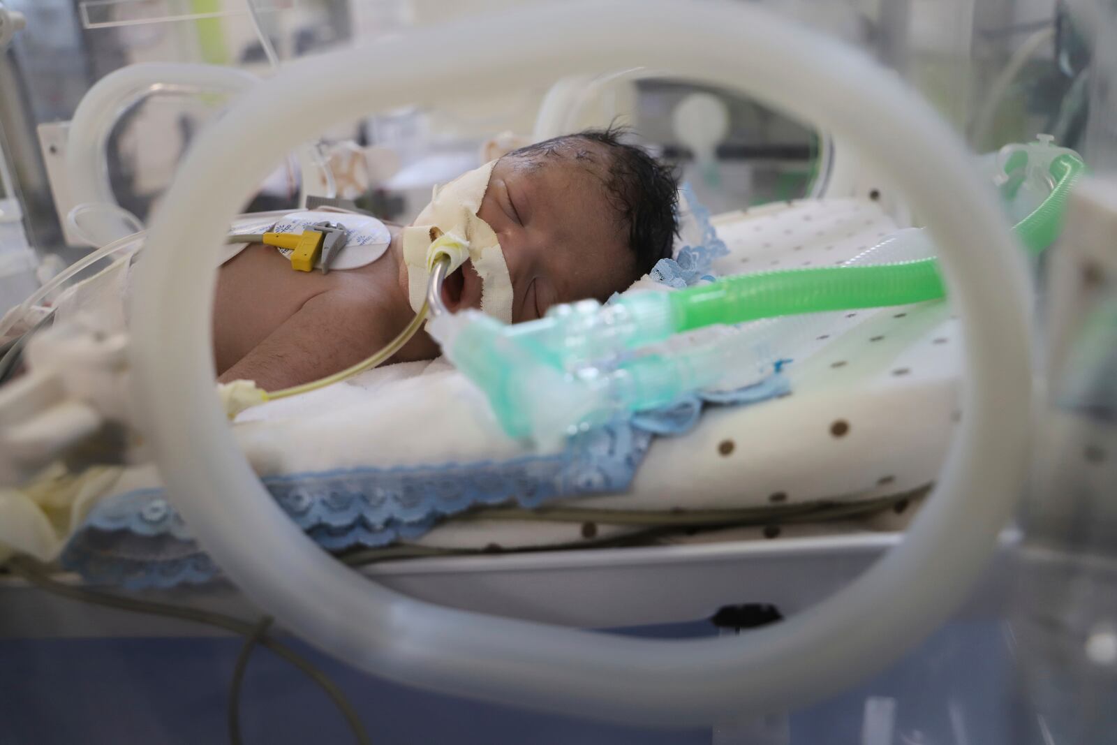 Newborn Soad Qeshtah seen in an incubator in Nasser Hospital in Khan Younis, hours before she died. Her mother, who was seven months pregnant, was killed in an Israeli airstrike in the Gaza Strip and the baby was delivered by emergency cesarean section, Monday, July 28, 2025. (AP Photo/Mariam Dagga)