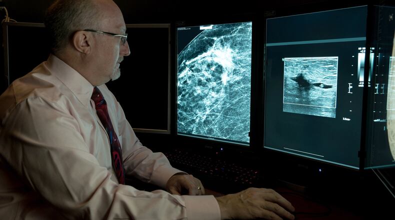 Diagnostic radiologist Dr. William Meyers with Kettering Health reads an ultrasound to determine the seed location and identify the area of affected breast tissue to be removed. CONTRIBUTED