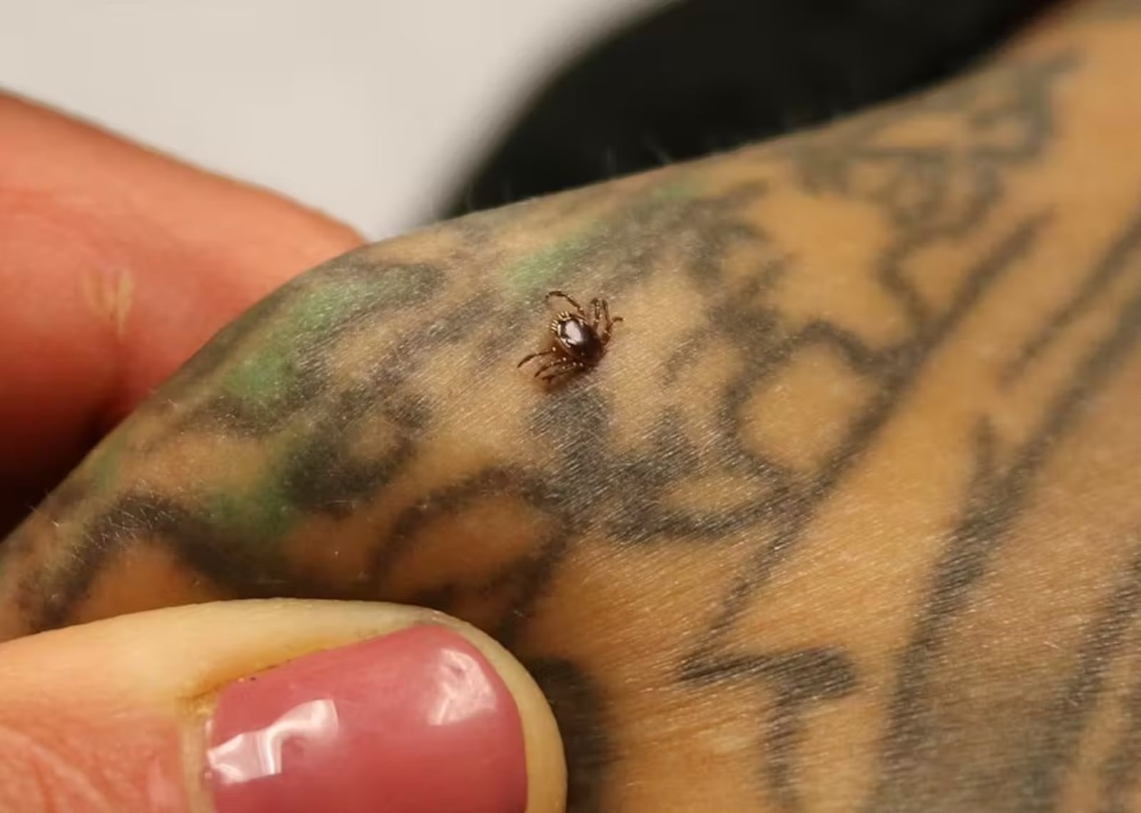 How a tick feeds. CREATIVE COMMONS/National Institute of Allergy and Infectious Diseases via Wikimedia Commons
