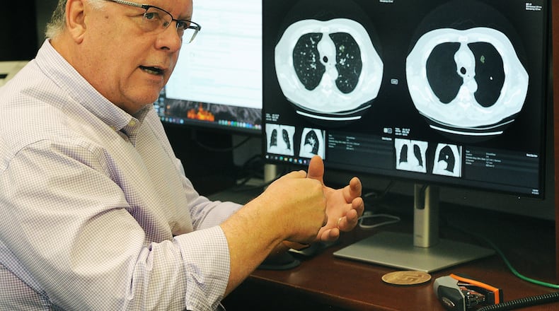 Steve Worrell, CEO, Riverain Technologies in Miamisburg. MARSHALL GORBY\STAFF