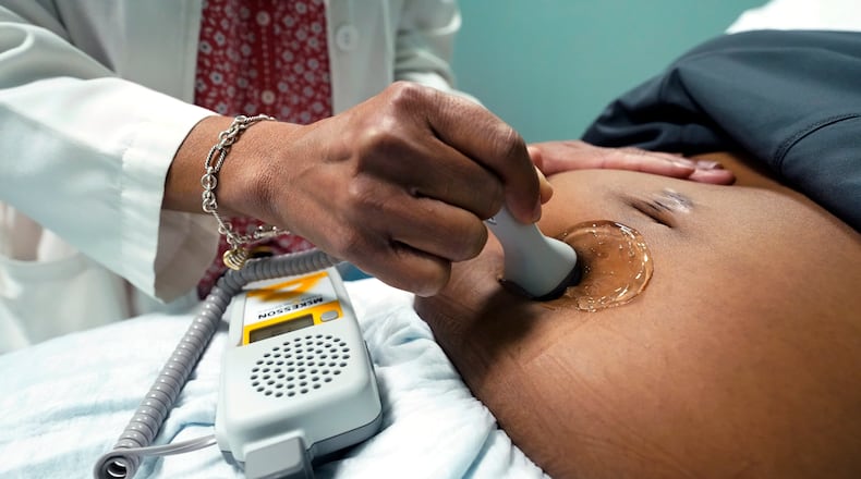 FILE - A doctor uses a hand-held Doppler probe on a pregnant woman to measure the heartbeat of the fetus on Dec. 17, 2021, in Jackson, Miss. Black women are at twice the risk of dying from pregnancy-related issues, according to the Centers for Disease Control. (AP Photo/Rogelio V. Solis, File)
