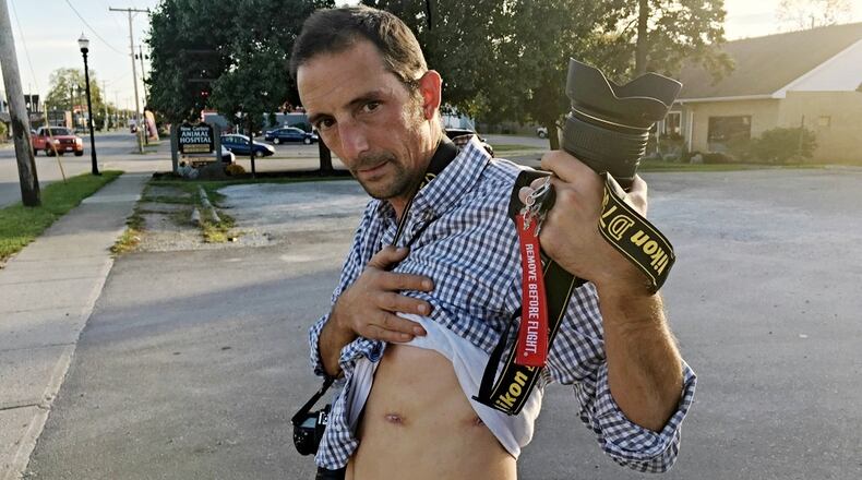 New Carlisle News photographer Andy Grimm on Friday, Oct. 20, 2017, shows where a bullet went in through his torso and out the side while on the scene of an accident. He was shot around 2 a.m. Sept. 4 when a Clark County Sheriff's deputy said he mistook Grimm's camera for a gun.