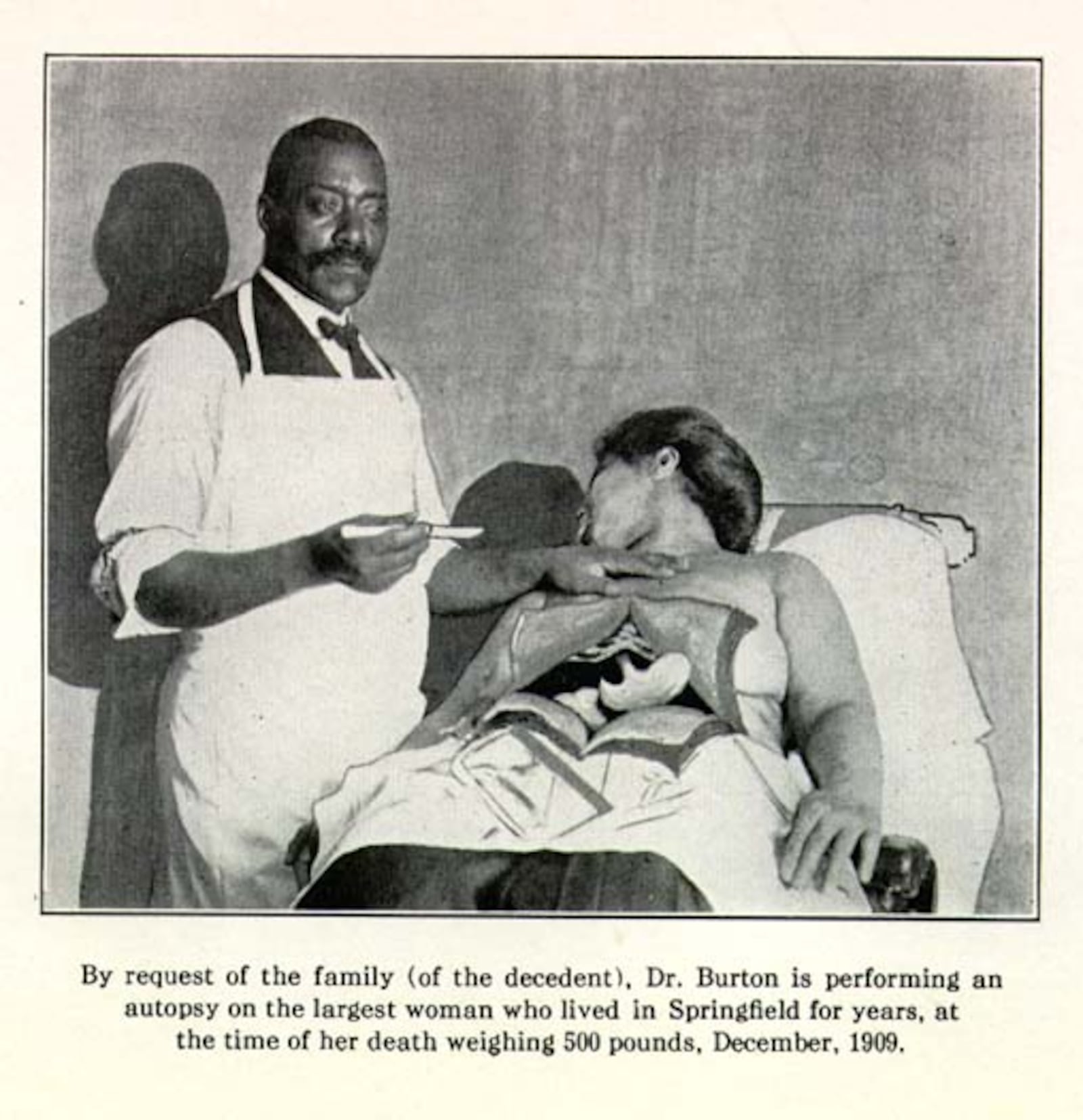 Dr. Thomas W. Burton performing an autopsy. Contributed