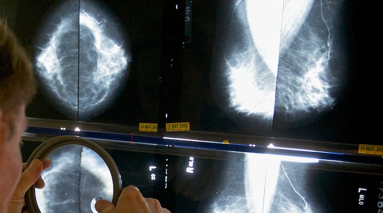 FILE - A radiologist uses a magnifying glass to check mammograms for breast cancer in Los Angeles, May 6, 2010. (AP Photo/Damian Dovarganes, File)