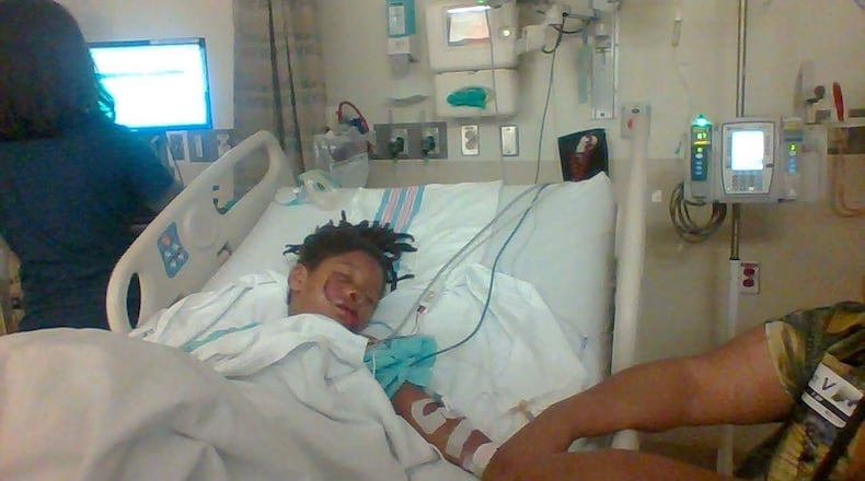 A 6-year-old boy is recovering at Dayton Children’s Hospital after being attacked by a dog in Springfield.