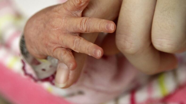 Ohio law requires newborn screening to be done on all babies born in the state. Analysis takes place in ODH’s Public Health Laboratory. Each year, the screenings help improve the health outcomes of nearly 300 babies, according to the state of Ohio. COURTESY OF THE OHIO LEGISLATIVE SERVICE COMMISSION