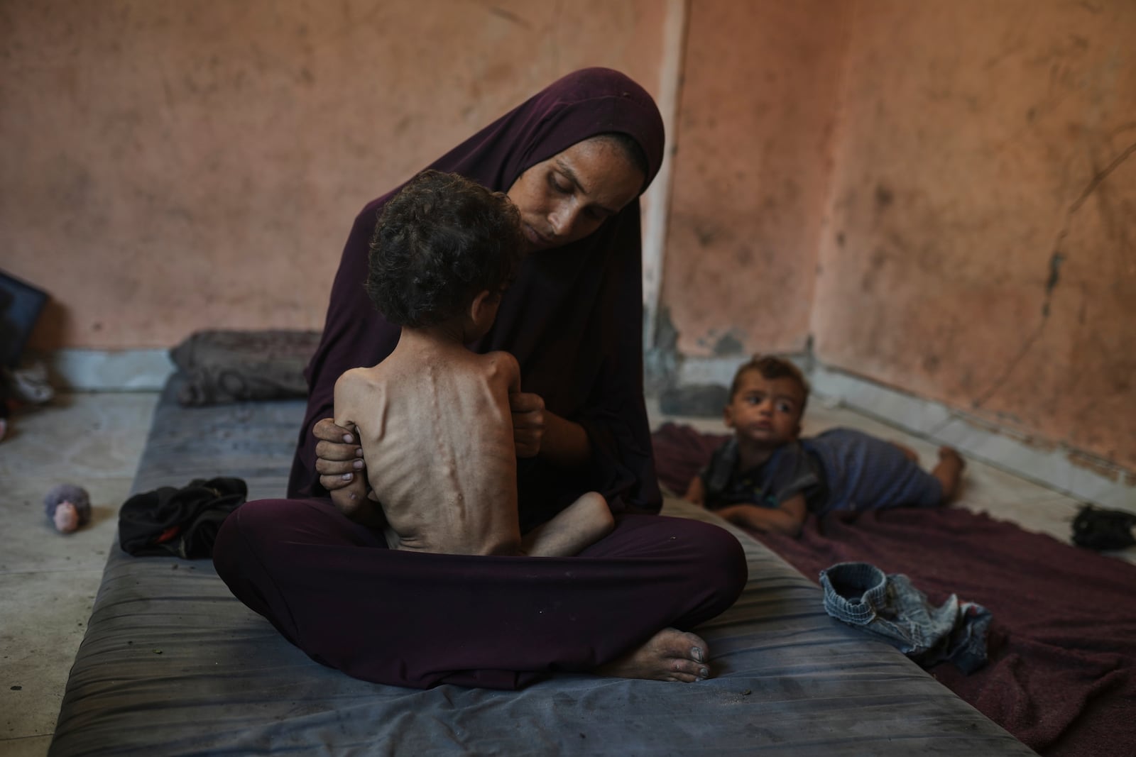 Naima Abu Ful poses for a photo with her 2-year-old malnourished child, Yazan, at their home in the Shati refugee camp in Gaza City on Wednesday, July 23, 2025. (AP Photo/Jehad Alshrafi)