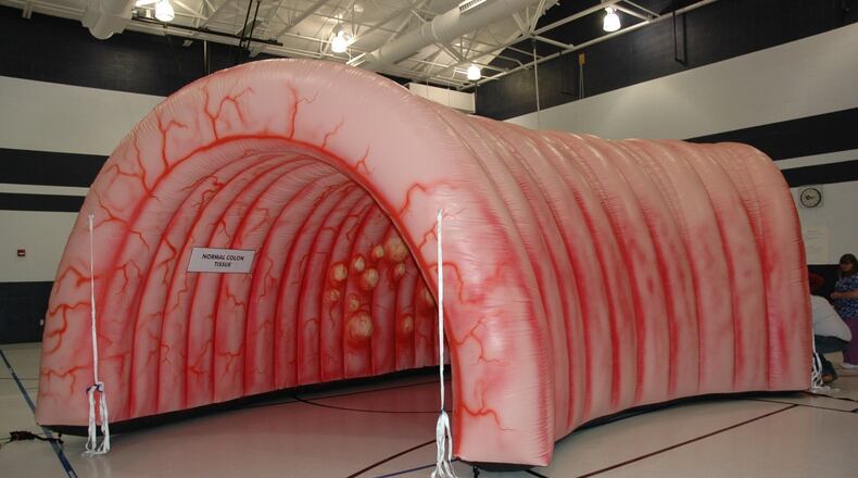 A giant inflatable walk-through colon is used to educate the community on their risk of acquiring colorectal cancer, how to get screened, and how to prevent cancer from reaching them or their family members. CONTRIBUTED