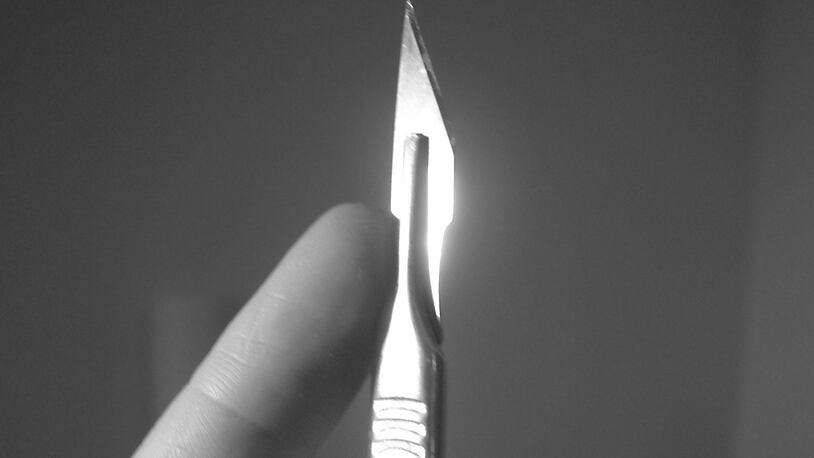 A scalpel. (Photo: aesop/Flickr/Creative Commons) https://creativecommons.org/licenses/by-sa/2.0/